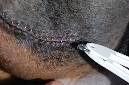 Blue - Removing Staples from Incision